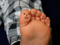 Smiley faces drawn on each toe of the sole of a foot