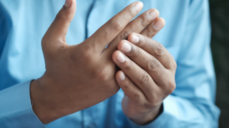 Arthritis - man holding painful fingers - Best Ways to Reducee Inflammation in the Body