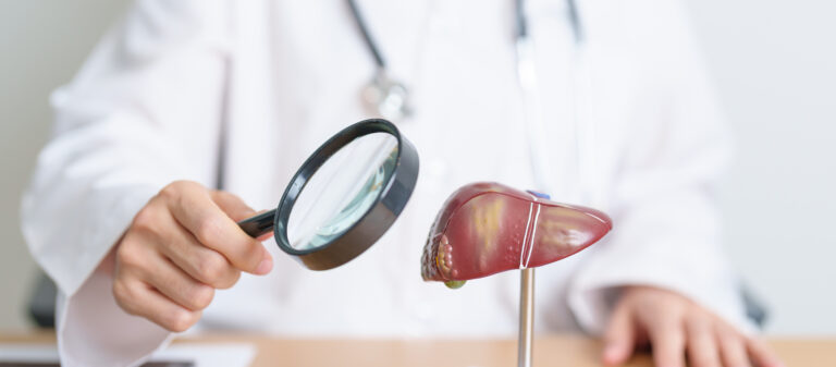 Doctor with human Liver model and Magnifying glass - 7 Early Signs and Symptoms of Liver Damage
